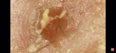 When looking at your skin through a microscope gos too far