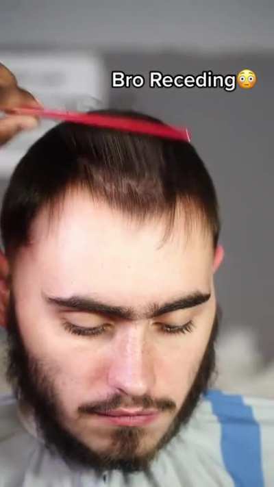 The way he messed up this client with the same lined up cut he does to all his clients.