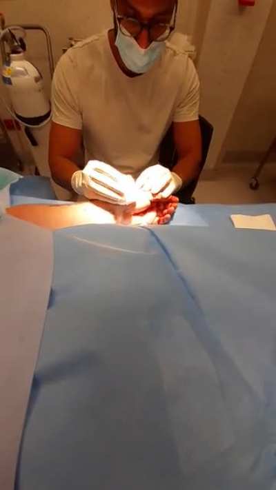 So I sliced an artery accidentally and needed surgery .. got some good distance!