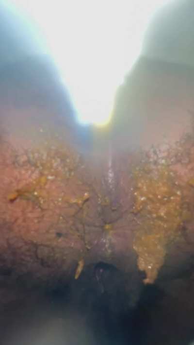 Your pov sitting under my fat messy hairy wet Black BBW ass when I have the runs