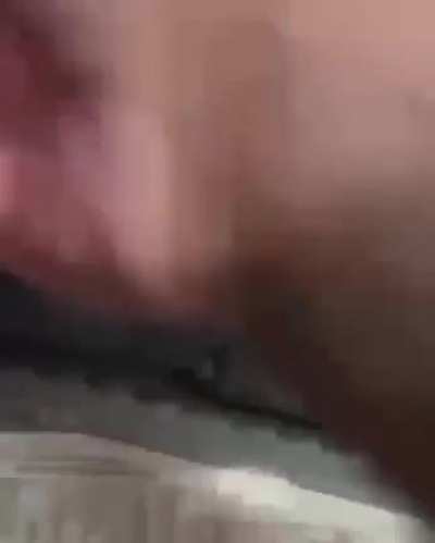 911