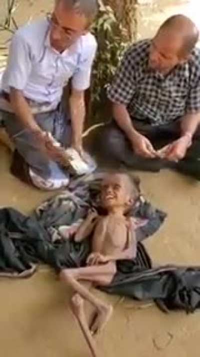 Attacks across Yemen causing mass poverty starvation &amp;amp; death. This is racism. This is child abuse.