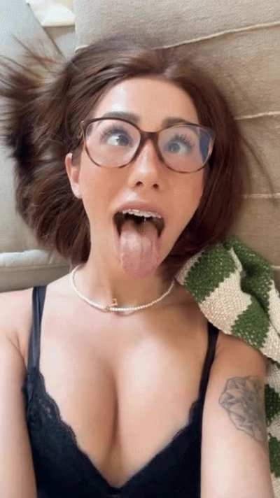 do i look better with braces?