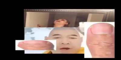 ∆aaaaaa∆