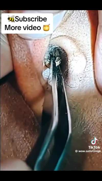 Gunk