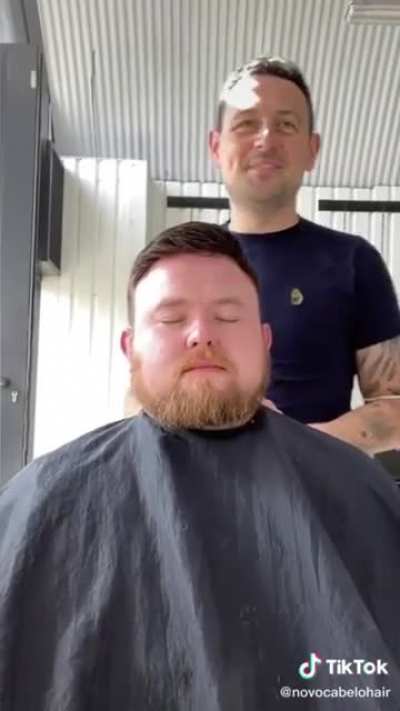 Man bursts into tears of happiness after getting a hair restoration