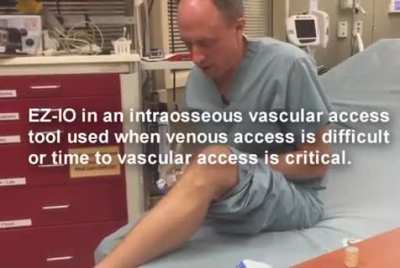 Doctor drills his own leg with IO needle! EZ-IO is an intraosseous vascular access tool that is used when venous access is difficult or time to get vascular access is critical.