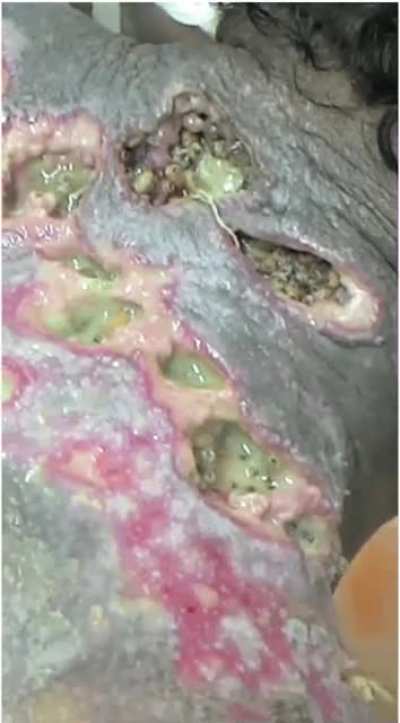 You&rsquo;re an ER doctor and a patient came in with this situation. Wdyd?