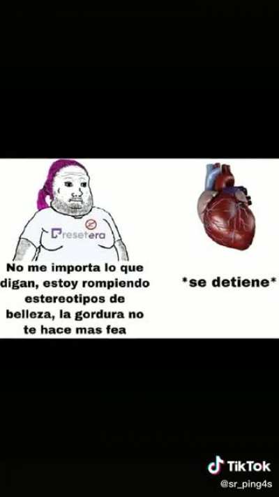 Retraso mental:
