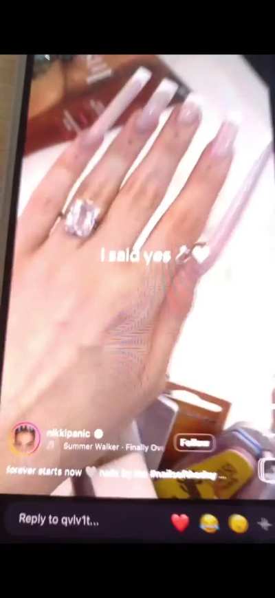 Weird sound when I slide my finger