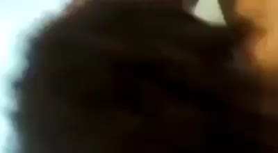 Garota do vitiligo