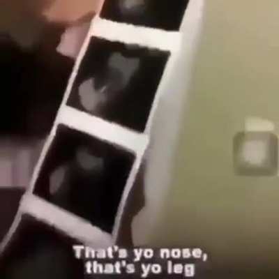 Damn