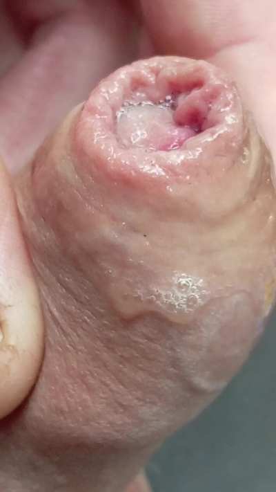 Tight until it's wet