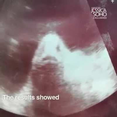 A woman pregnant with fish