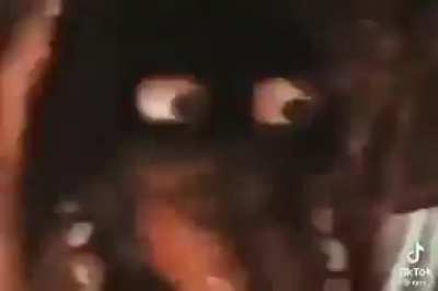 br ai n da m age