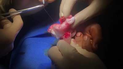 *GRAPHIC* Here&rsquo;s the video of me getting patched up from the injury in my previous post. The whole vid was too long but the navy docs did an outstanding job. If watching this doesn&rsquo;t make you suffer though idk what will!
