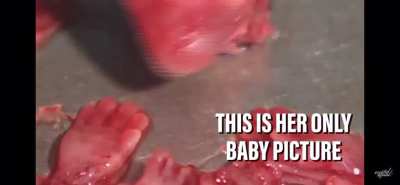 The reality of Abortion
