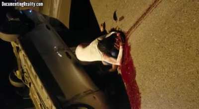 Guy has his skull smashed in a car accident and his gf/wife looses it.