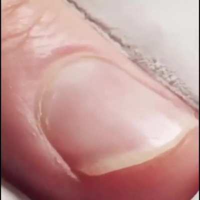 Nail growing