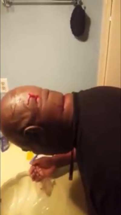 Cheap razors/rubbing alcohol&hellip; You missed a spot