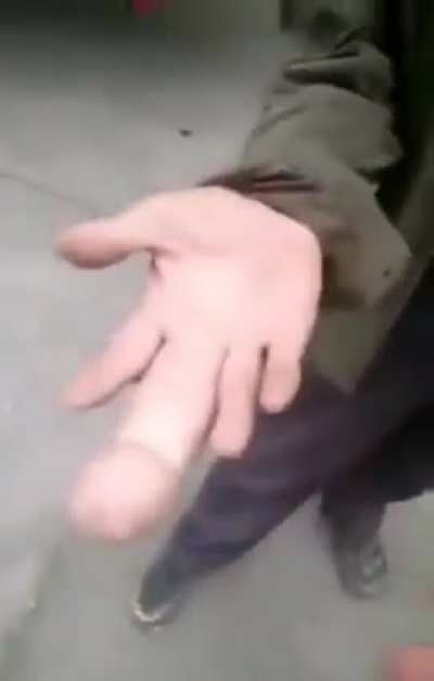 of a finger