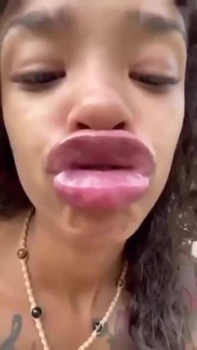 l