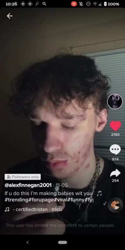 He genuinely repulses me bro he's so hard to look at