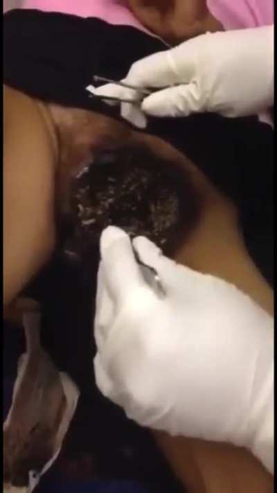 Maggots in female pussy
