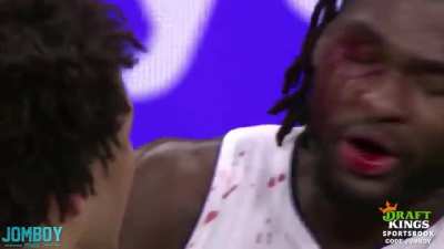 [Jomboy] Isaiah Stewart charges LeBron after being bloodied, a breakdown