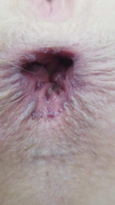 Anal gape GIF by ashlywinters