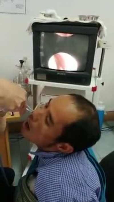 Got a bit of an itch up my nose.