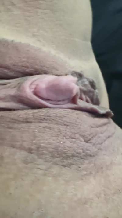 My clit use to make me insecure