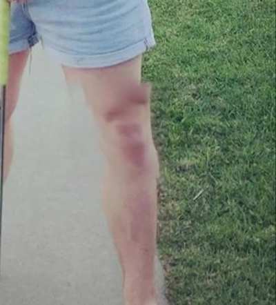 Ludwig's knee is very talented