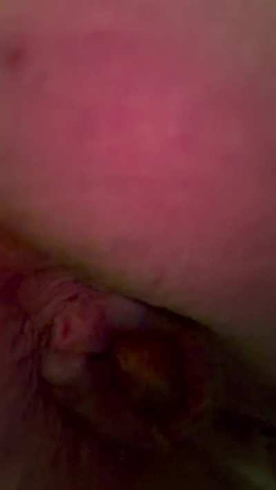 I was pushing so hard ! For a baby poop 💩 to come out 😅 how’s the view 👅 [F]
