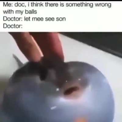 😳