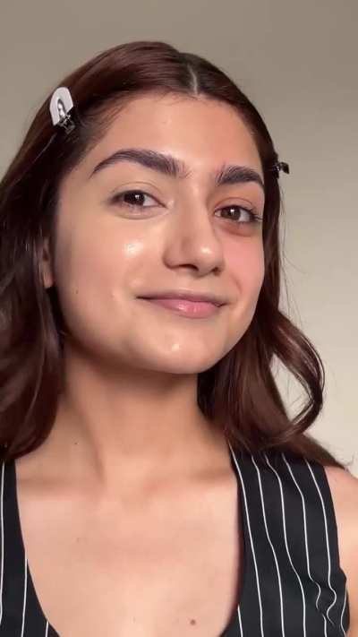 That mole of Amulya keeps distracting me from NNN
