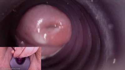 cervix sounding orgasms POV splitscreen