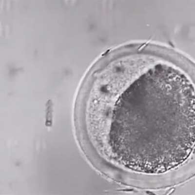 &ldquo;This device helps bad sperm get into the egg&rdquo; || Now even retarded sperms are being given trophies. What a time to be alive! I&rsquo;ll walk to the pot myself.