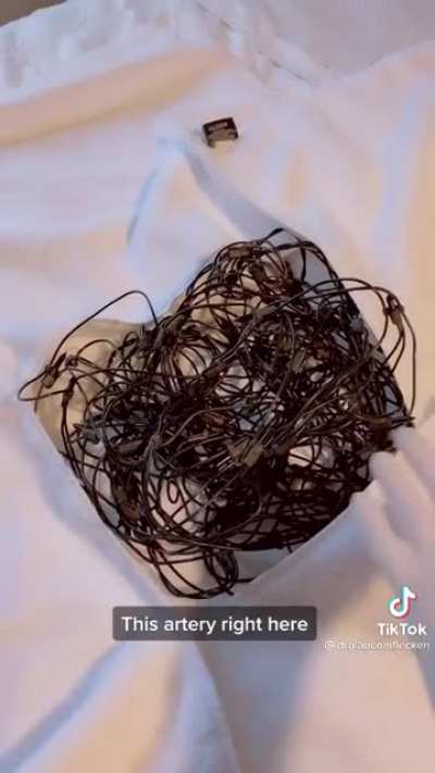 this gives me PTSD