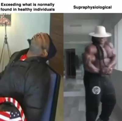 Fuck yea bro