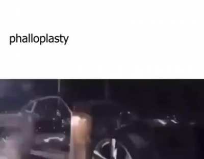 THIS IS