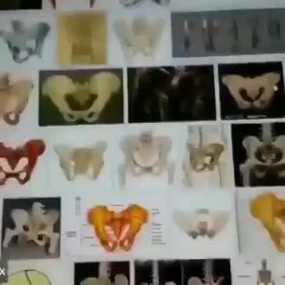 Bone(r)🦴