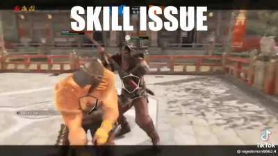 Skill issue.