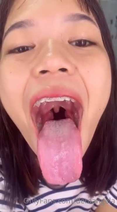 of tease
