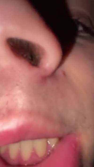 moist man face reveal