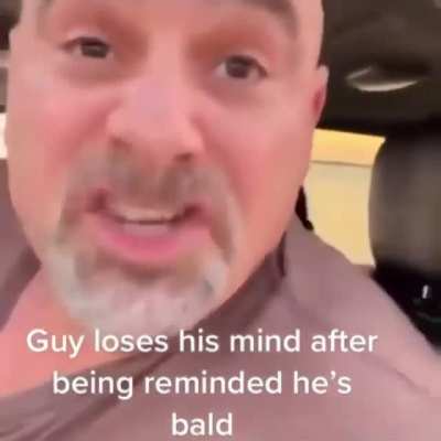 You have no hair, sweetie
