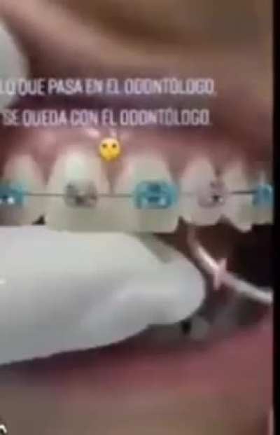 Dente