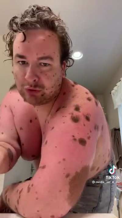 Potter better look out...this dudes shoulder hair porn game is on point