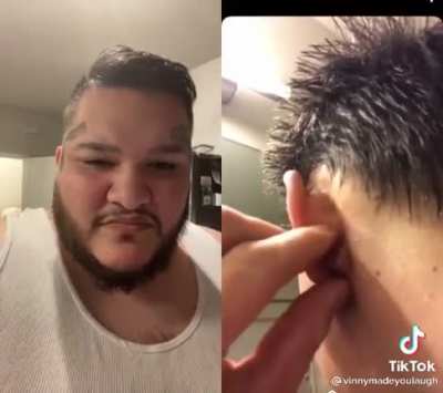 I still don&rsquo;t understand why people like pimple popping videos