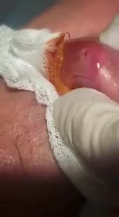 Grub worm getting pulled out of someone&rsquo;s lips